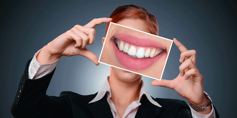 الفرق بين عدسات الأسنان ابتسامة هوليود