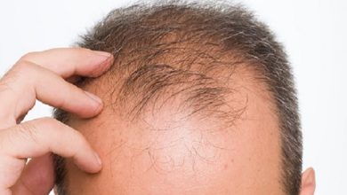 Photo of علاج تساقط الشعر عند الرجال في سن مبكر